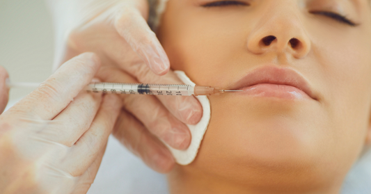Jeune femme recevant une injection d'acide hyaluronique dans les lèvres, illustrant les considérations à prendre en compte avant d’opter pour ce type de traitement esthétique.