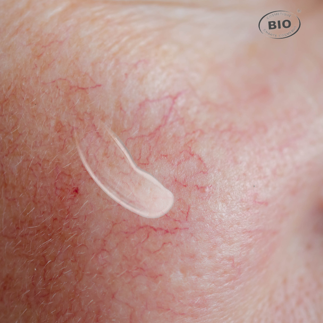 Gros plan sur une peau réactive présentant des rougeurs diffuses avec application d'une crème naturelle apaisante certifiée bio Phyt’s pour les peaux sensibles.