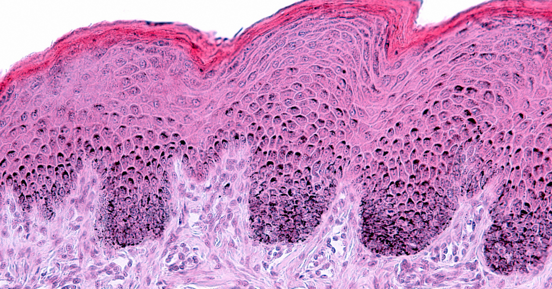 Comment fonctionne la peau et comment ralentir son vieillissement