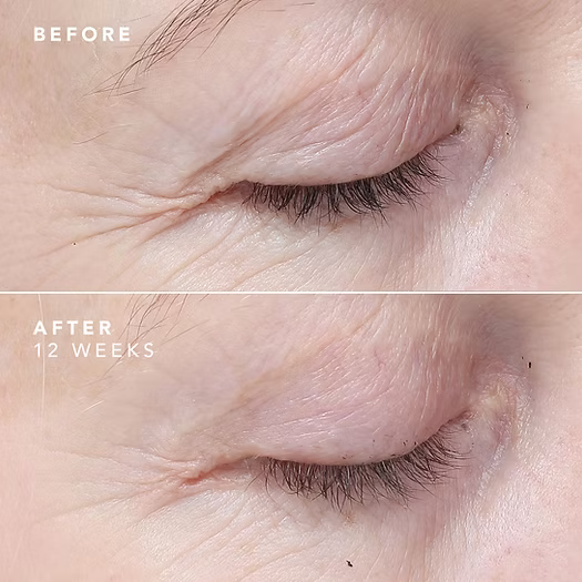 Comparaison visuelle avant et après 30 jours d’utilisation de la EGF Power Cream Bioeffect. Peau plus lisse, plus ferme et visiblement rajeunie.