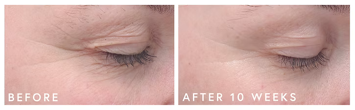 Résultats visibles avant et après du sérum yeux EGF Bioeffect, illustrant l’effet lissant et éclaircissant sur le contour de l’œil.