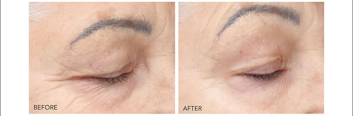 Cure de 30 jours BIOEFFECT – Traitement rajeunissant intensif