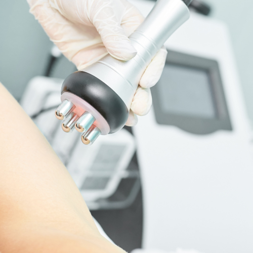 On voit ici l'appareil quadripolaire de radiofréquence pour un traitement corps anti-cellulite et raffermissant.